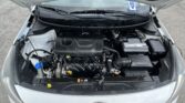 Open hood view of a Kia sedan showing the engine, battery, and windshield area under the raised hood.