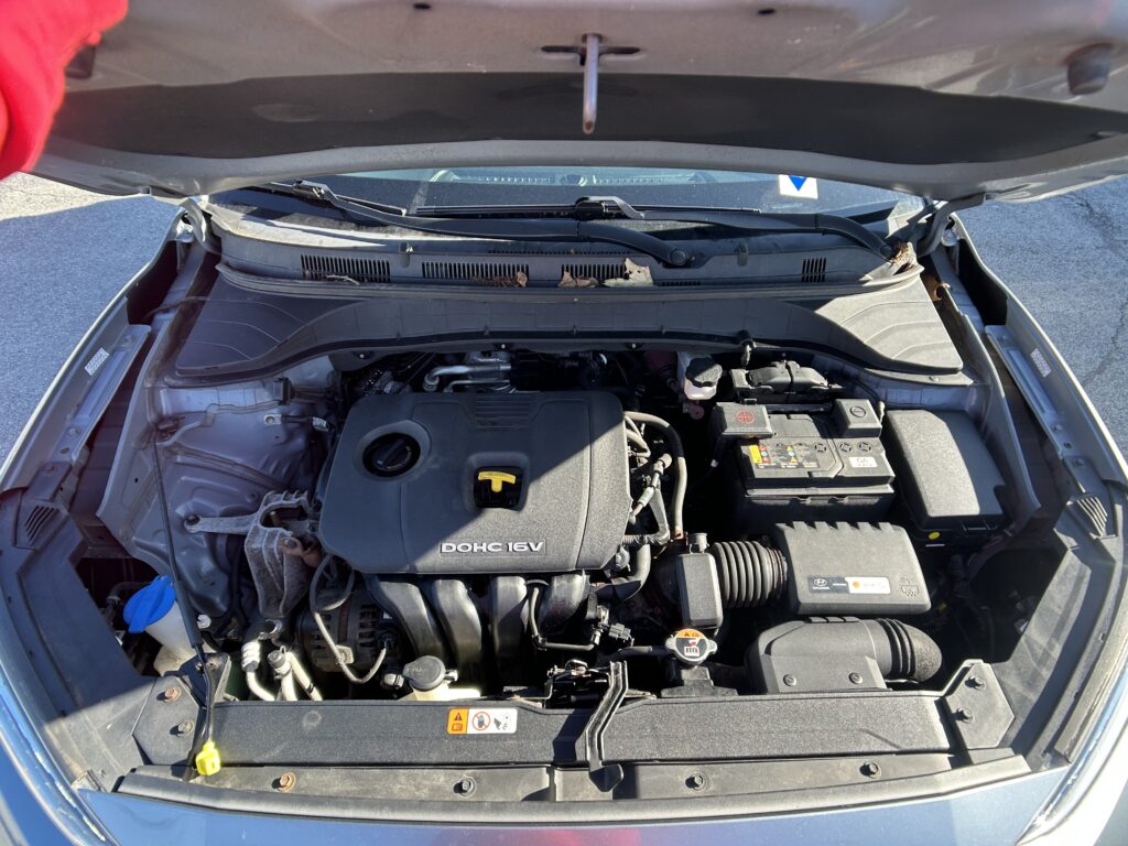 Front of a car with the hood open, showing the engine bay, battery, and various hoses and components.